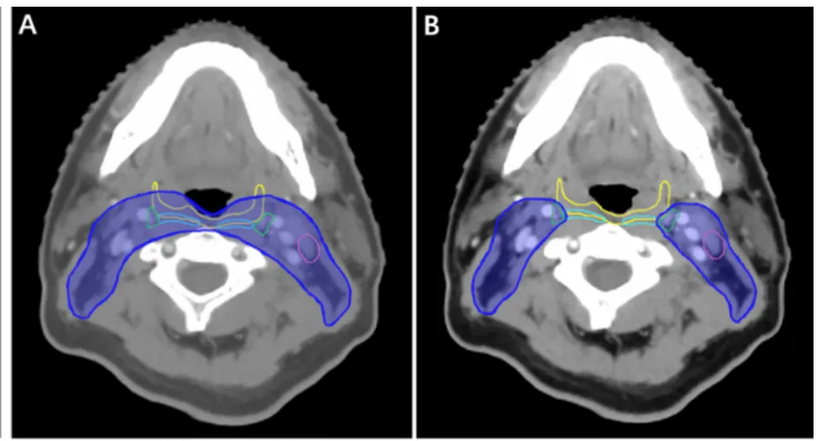 Case 5 illustration